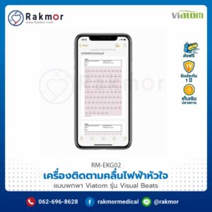 เครื่องติดตามคลื่นไฟฟ้าหัวใจแบบพกพา Viatom รุ่น Visual beats