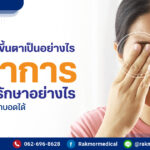 เครื่องตรวจน้ำตาล
