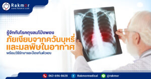 โรคถุงลมโป่งพอง อันตรายอย่างไร มีวิธีป้องกันและรักษายังไงบ้าง