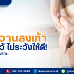 เบาหวานลงเท้า