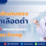 หลอดเลือดดำ