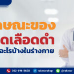 หลอดเลือดดำ