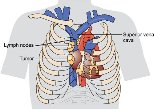 หลอดเลือดดำใหญ่ (Superior vena cava)
