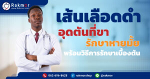เส้นเลือดดําอุดตันที่ขา รักษา