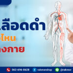 เส้นเลือดดำอยู่ตรงไหนของร่างกาย