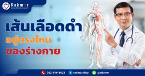 เส้นเลือดดำอยู่ตรงไหนของร่างกาย