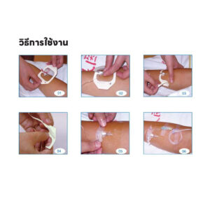 แผ่นฟิล์มใสสำหรับปิดแผล ยี่ห้อ ZD